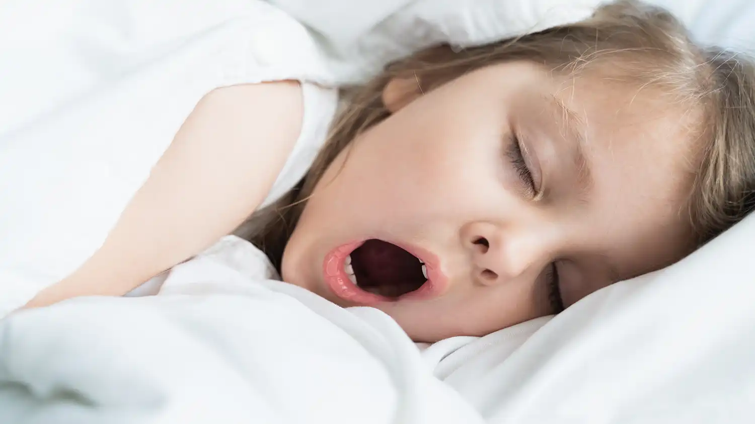 Sleep Apnoea In Children