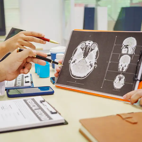 What Are Skull Base Tumours?
